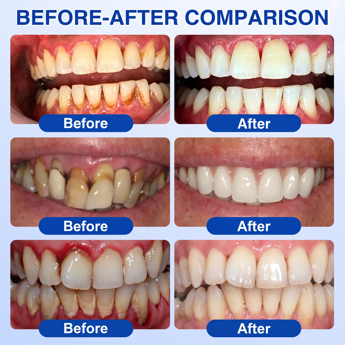 🦷𝑷𝒖𝒓𝒆𝒍𝒐𝒓𝒂® GumRevive periodontal repair gel