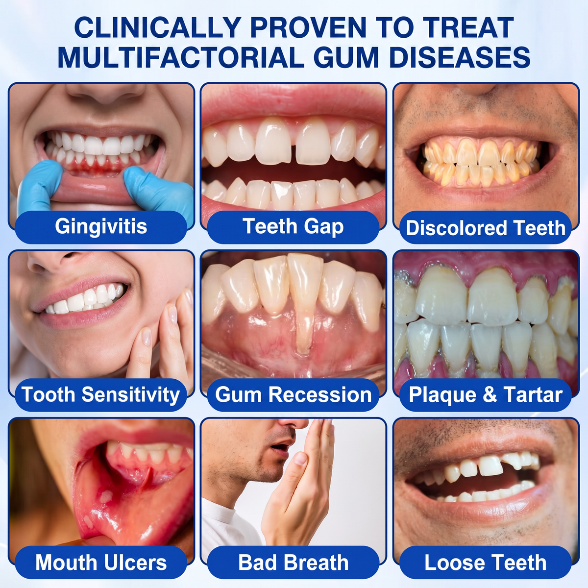 🦷𝑷𝒖𝒓𝒆𝒍𝒐𝒓𝒂® GumRevive periodontal repair gel