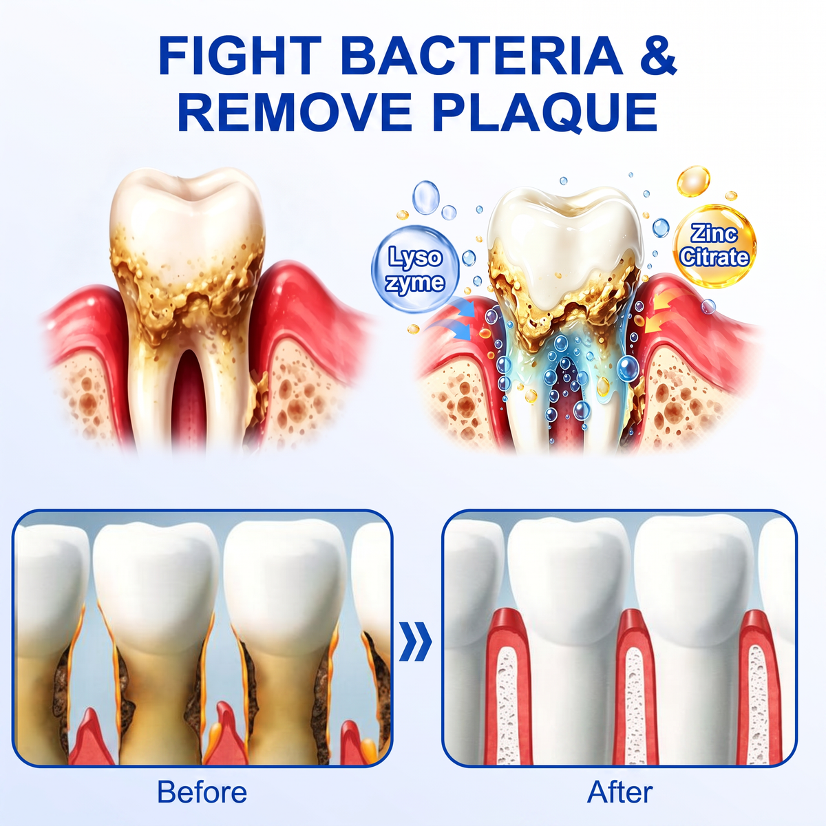 🦷𝑷𝒖𝒓𝒆𝒍𝒐𝒓𝒂® GumRevive periodontal repair gel