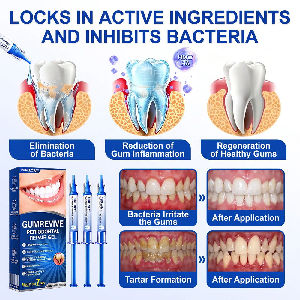 🦷𝑷𝒖𝒓𝒆𝒍𝒐𝒓𝒂® GumRevive periodontal repair gel