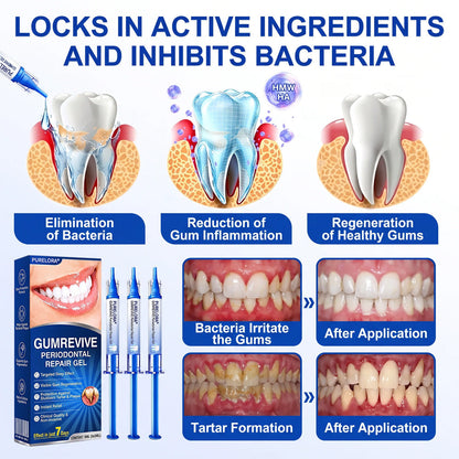 🦷𝑷𝒖𝒓𝒆𝒍𝒐𝒓𝒂® GumRevive periodontal repair gel