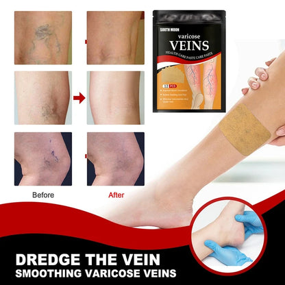 Varicose Vein Patch – Soothing Care for Tired Legs